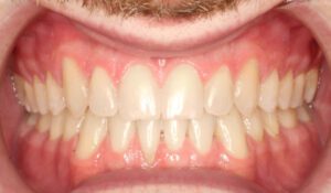 Take A Look At Our Orthodontics Work