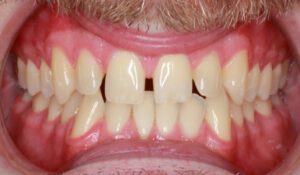 Take A Look At Our Orthodontics Work