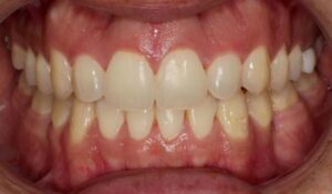Take A Look At Our Orthodontics Work