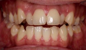 Take A Look At Our Orthodontics Work