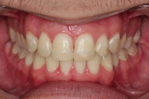 Take A Look At Our Orthodontics Work