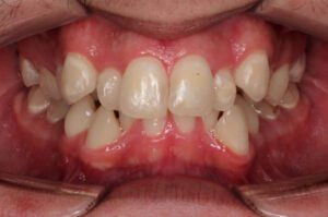 Take A Look At Our Orthodontics Work